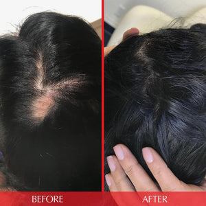 HAIRtamin Advanced Formula 3 Month