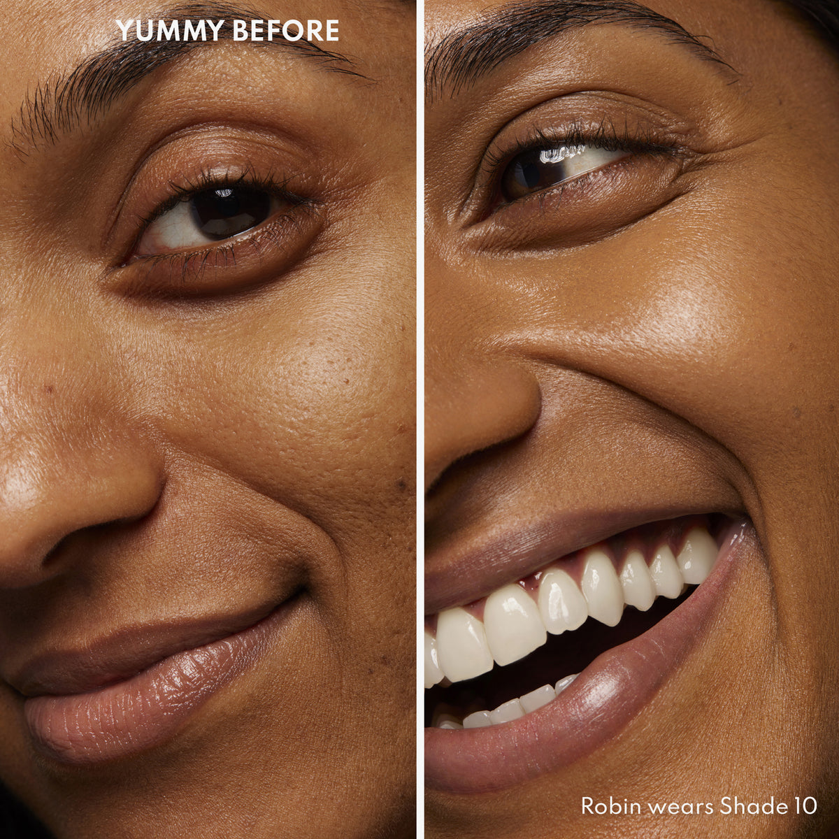 Vorher-Nachher-Bild einer Frau mit mittlerem bis dunklem Hautton nach Anwendung des Yummy Skin Serum Tint 10 – sichtbar ebenmäßiger Teint.