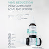 Infografik; Zwei Flaschen des Serum, mit Text zur Reduzierung von entzündlicher Akne und Läsionen, der die Produktvorteile aufzeigt.
