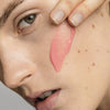 Nahaufnahme des Gesichts einer Frau, auf deren Wange Spectra-Rosa-Gel aufgetragen wird.