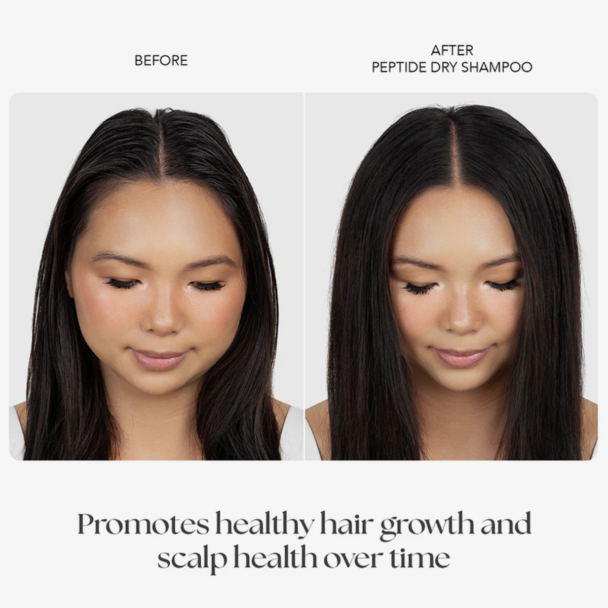 Frau in zwei nebeneinander gestellten Fotos – links „vor“ und rechts „nach“ der Anwendung des Peptide Dry Shampoo – danach mit sichtbar frischerem, weniger fettigem Haar.