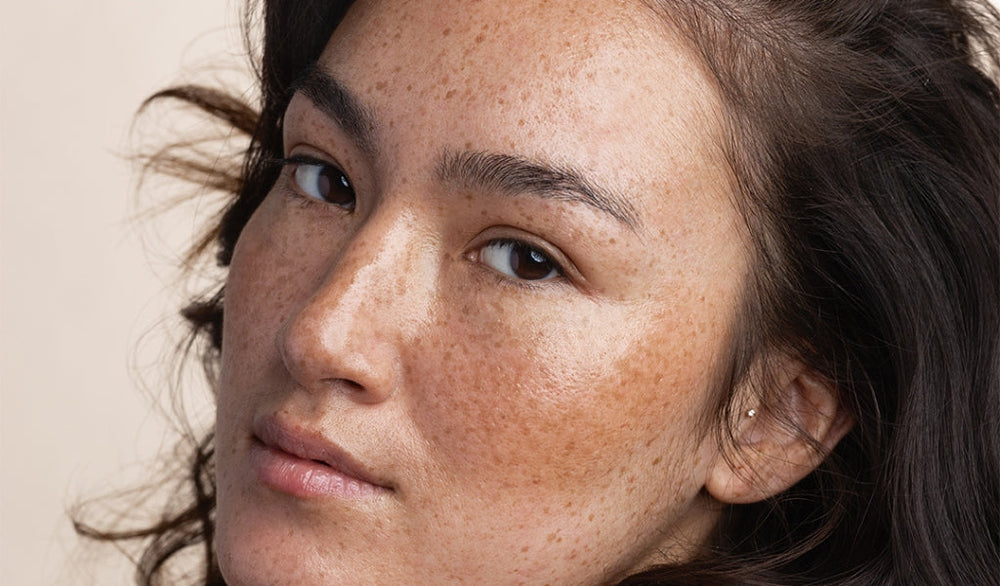 Nahaufnahme eines Gesichts mit Sommersprossen und natürlicher Hautstruktur, Person blickt ruhig in die Kamera.