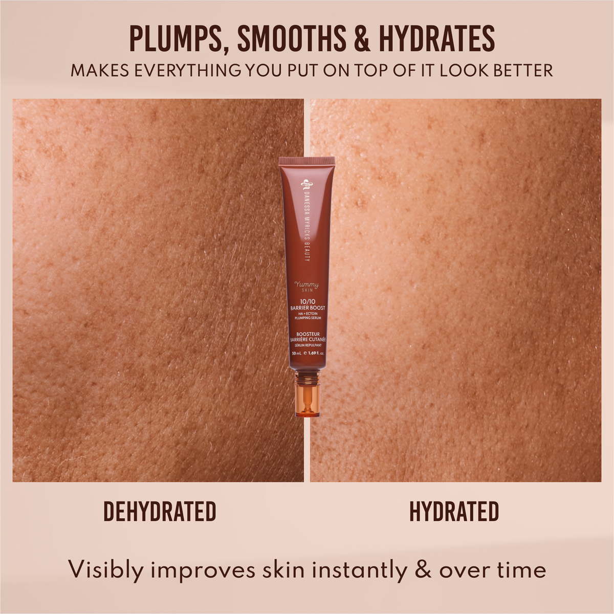Eine Tube Yummy Skin 10/10 Barrier Boost wird zwischen Nahaufnahmen von dehydrierter und hydrierter Haut gezeigt; der Text zeigt die sichtbaren Vorteile der Feuchtigkeitscreme für die Haut.