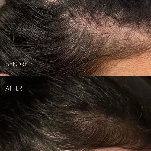 Das Haarserum