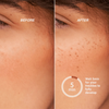 Nahaufnahmen der Wangen zeigen, wie Freck OG von Freck Beauty in nur 5 Minuten Sommersprossen erzeugt.
