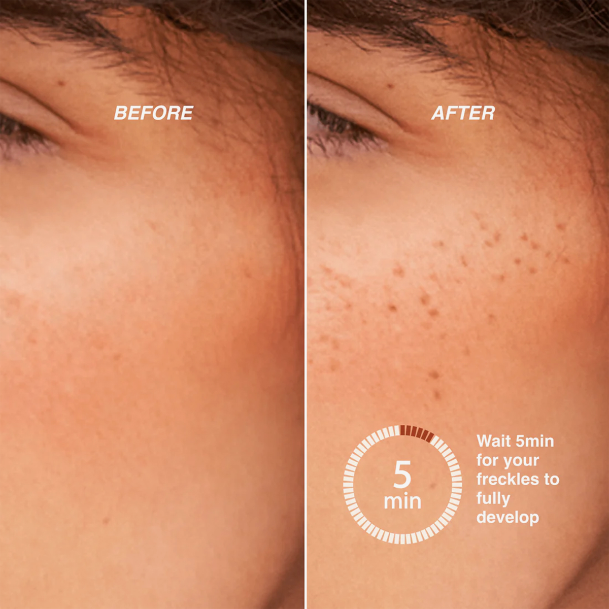 Nahaufnahmen der Wangen zeigen, wie Freck OG von Freck Beauty in nur 5 Minuten Sommersprossen erzeugt.