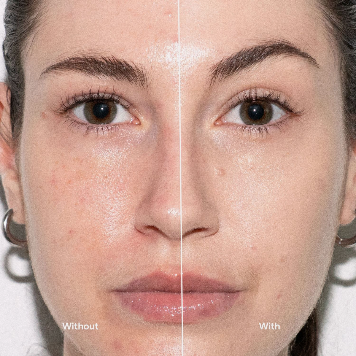Das Bild mit der geteilten Gesichtshälfte zeigt eine Frau mit Hautunreinheiten auf der linken Seite und glatterer Haut auf der rechten Seite nach der Anwendung der Foundation „Ctrl+ SKIN“ von LH Cosmetics.
