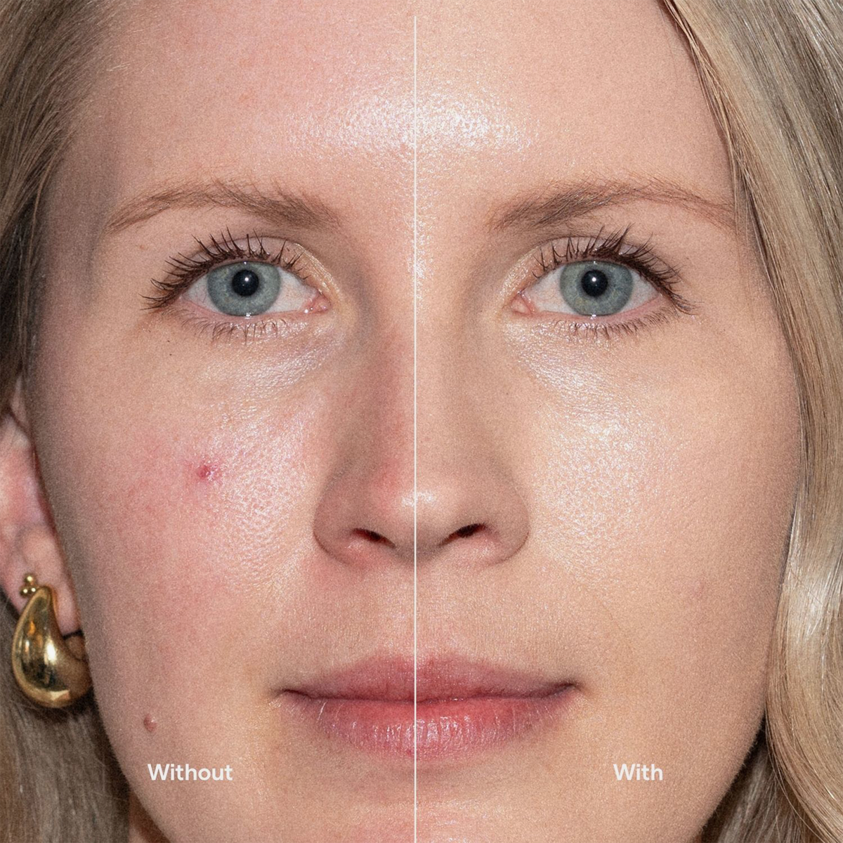 Die eine Hälfte ihres Gesichts weist Hautunreinheiten auf; die andere Hälfte sieht dank der „Ctrl+ SKIN“-Grundierung von LH Cosmetics glatt und ebenmäßig aus.