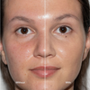 Links: ungeschminkte Haut mit Rötungen; rechts: „Ctrl+ SKIN“-Foundation von LH Cosmetics – glatterer, ebenmäßigerer Teint.