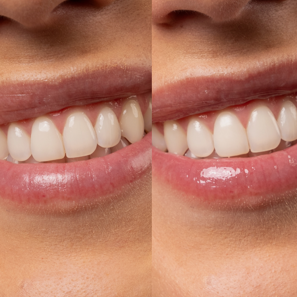Nebeneinanderstellung der Lippen vor und nach dem Auftragen von Lipgloss SPF50.