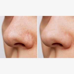 Heartleaf Pore Control Cleansing Oil