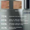 Nahaufnahme von Haut vor und nach Behandlung mit MERME More Moisture Face Serum, inklusive Nutzerzufriedenheitsstatistiken auf Deutsch.