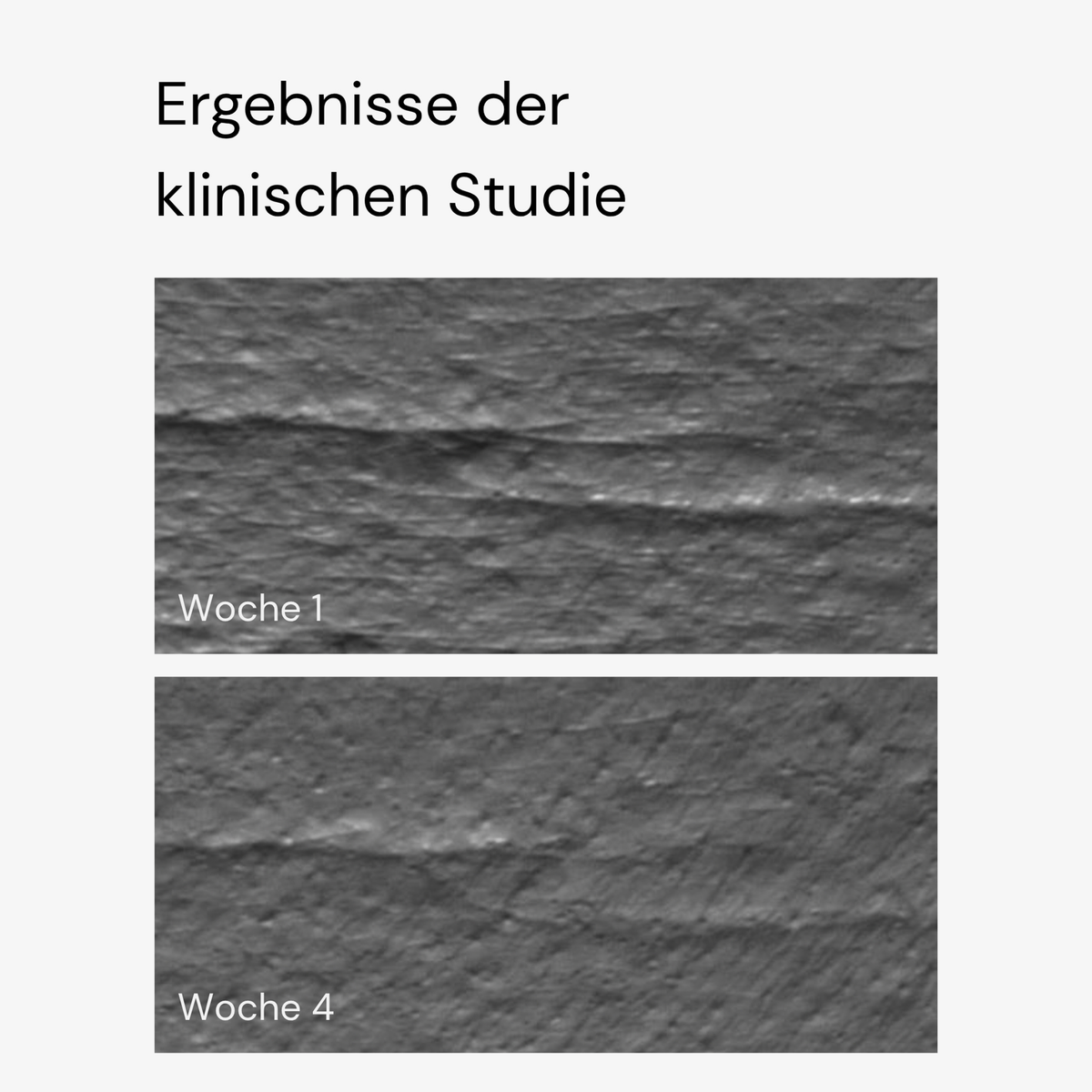 Zwei Nahaufnahmen der Haut in Graustufen mit den Bezeichnungen Woche 1 und Woche 4 zeigen eine verbesserte Textur nach der Anwendung von MERME New by Morning Retinal Face Serum.