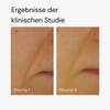 Nahaufnahmen der Haut in der Nähe eines Mundes zeigen die klinischen Ergebnisse der Woche 1 und Woche 4 mit MERME Super Stable C Face Serum.