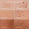 Sechs Nahaufnahmen zeigen das Verblassen von Freck OG von Freck Beauty auf verschiedenen Hauttönen, beschriftet mit After 5 Seconds und After 5 Minutes.