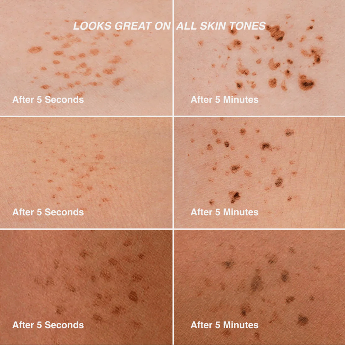 Sechs Nahaufnahmen zeigen das Verblassen von Freck OG von Freck Beauty auf verschiedenen Hauttönen, beschriftet mit After 5 Seconds und After 5 Minutes.