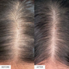 Nahaufnahme der Kopfhaut vor und nach der Anwendung von HAIRtamin Advanced Formula, wobei auf dem Nachher-Bild eine Verringerung des Haarausfalls und volleres Haar zu erkennen sind.