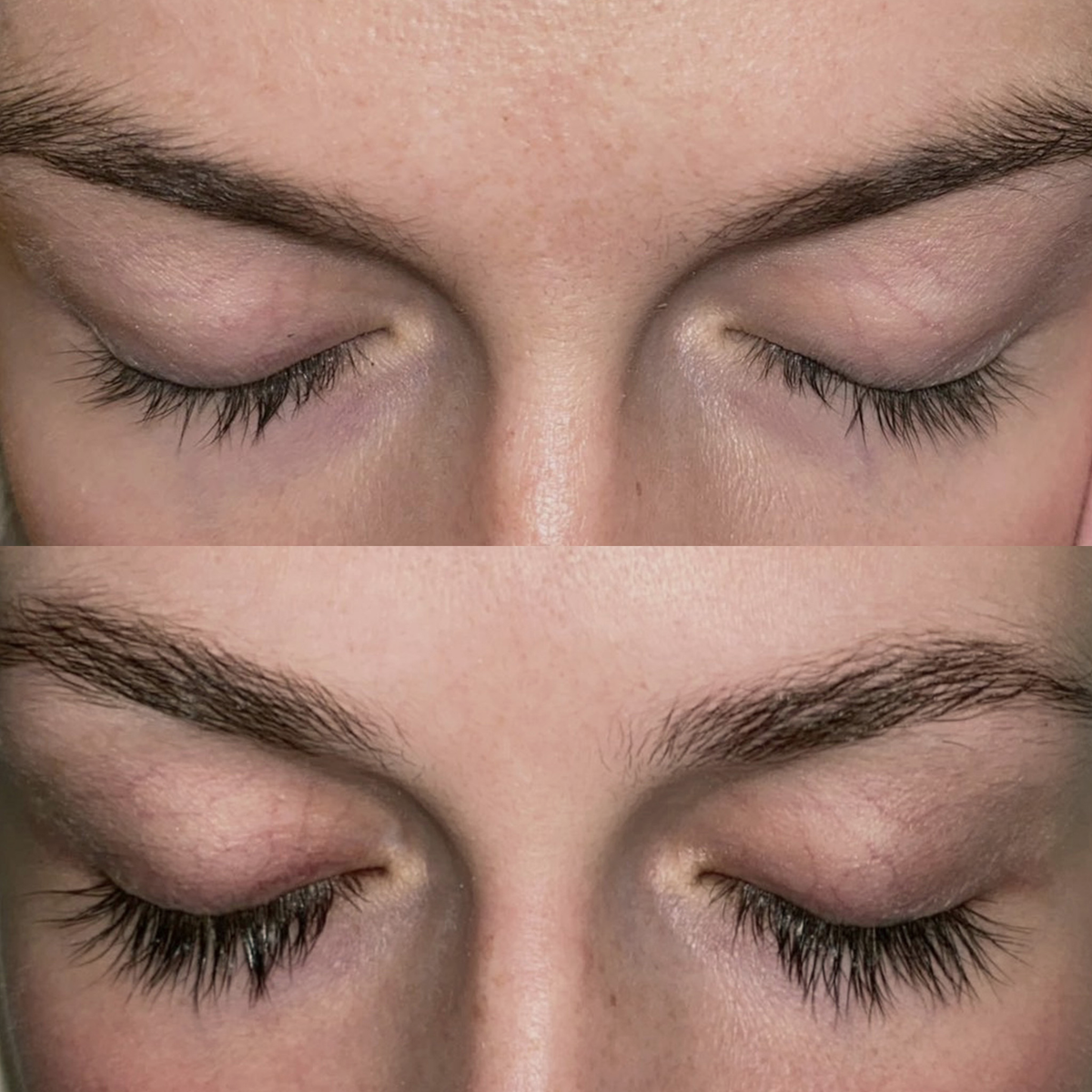 Nahaufnahme geschlossener Augen, die die Wimpern vor (oben) und nach (unten) der Anwendung des XLASH Xlash Wimpernserenums – 1 ml – zeigt.