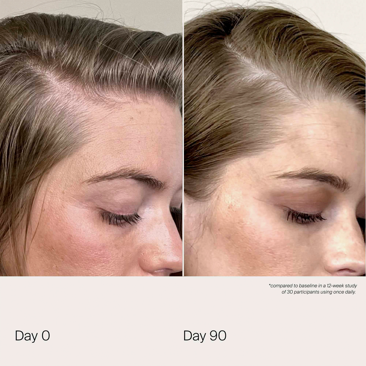 Scalp Care Density Serum