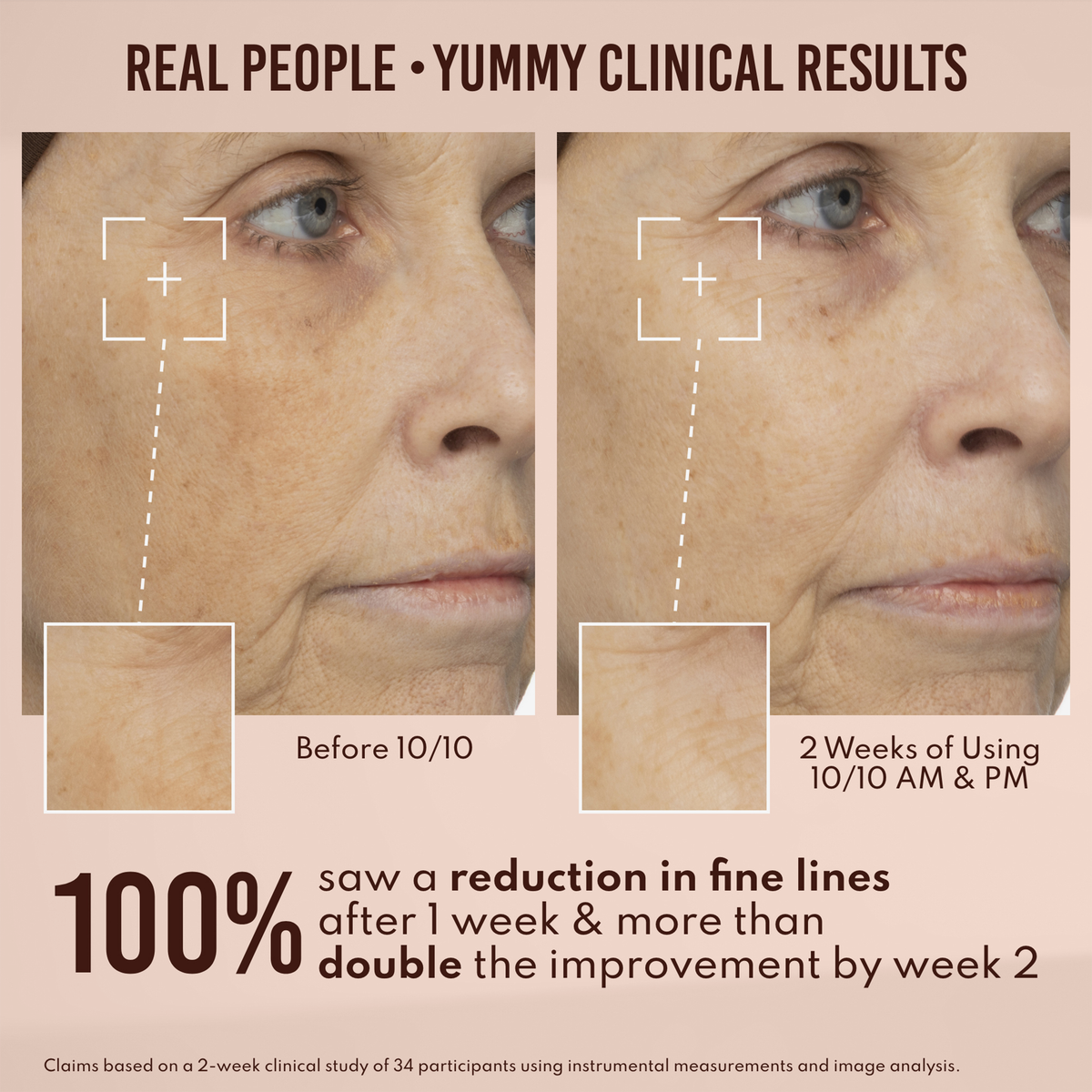 Die Nahaufnahme des Gesichts einer Frau zeigt die sichtbare Verringerung feiner Linien nach 2 Wochen Anwendung von Beauty Yummy Skin 10/10 Barrier Boost, wobei der Vergleichstext die Verbesserung hervorhebt.