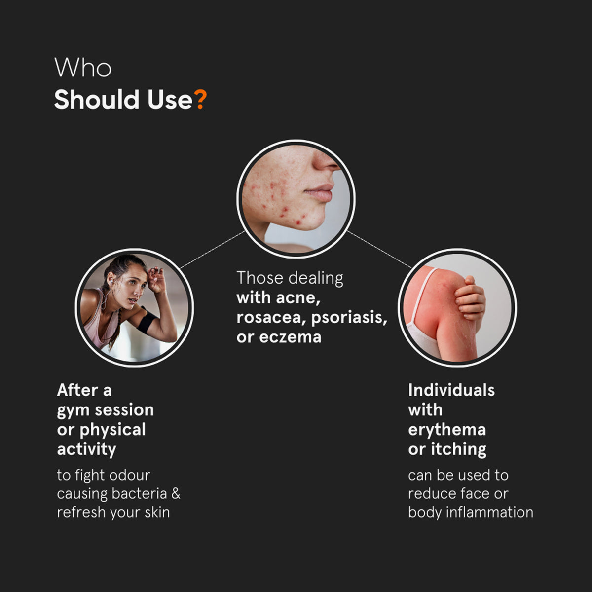 Drei Kreise zeigen: eine Frau beim Training, ein Gesicht mit Akne und eine Person, die sich einen roten Ausschlag kratzt - alles mögliche Anwendungen für Minimalist HOCl Skin Purifying Spray 150ppm.