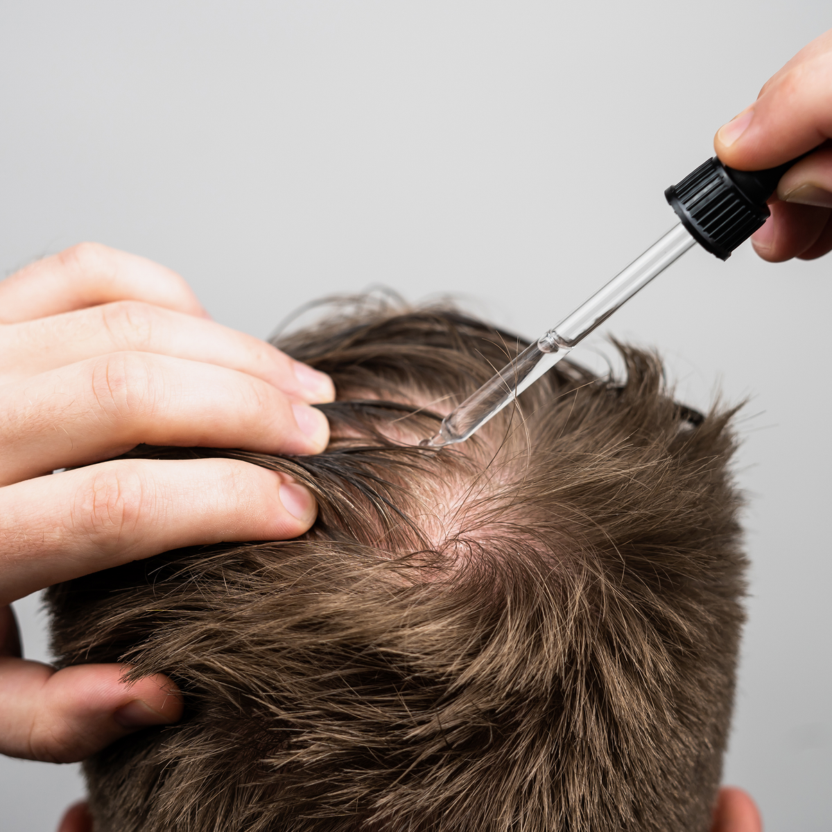 Ein Mann trägt Scandinavian Biolabs Bio Plixin Serum+ Men mit einer Pipette auf den Scheitel seiner Kopfhaut auf.