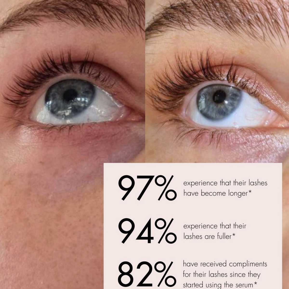 Eine Vorher-Nachher-Nahaufnahme eines Auges, die längere, vollere Wimpern dank des SWEED Wimpernwachstumsserums und begeisterte Komplimente zeigt.