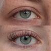 Nahaufnahme eines blaugrünen Auges vor (oben) und nach (unten) der Anwendung des XLASH Xlash Wimpernseren – 1 ml.